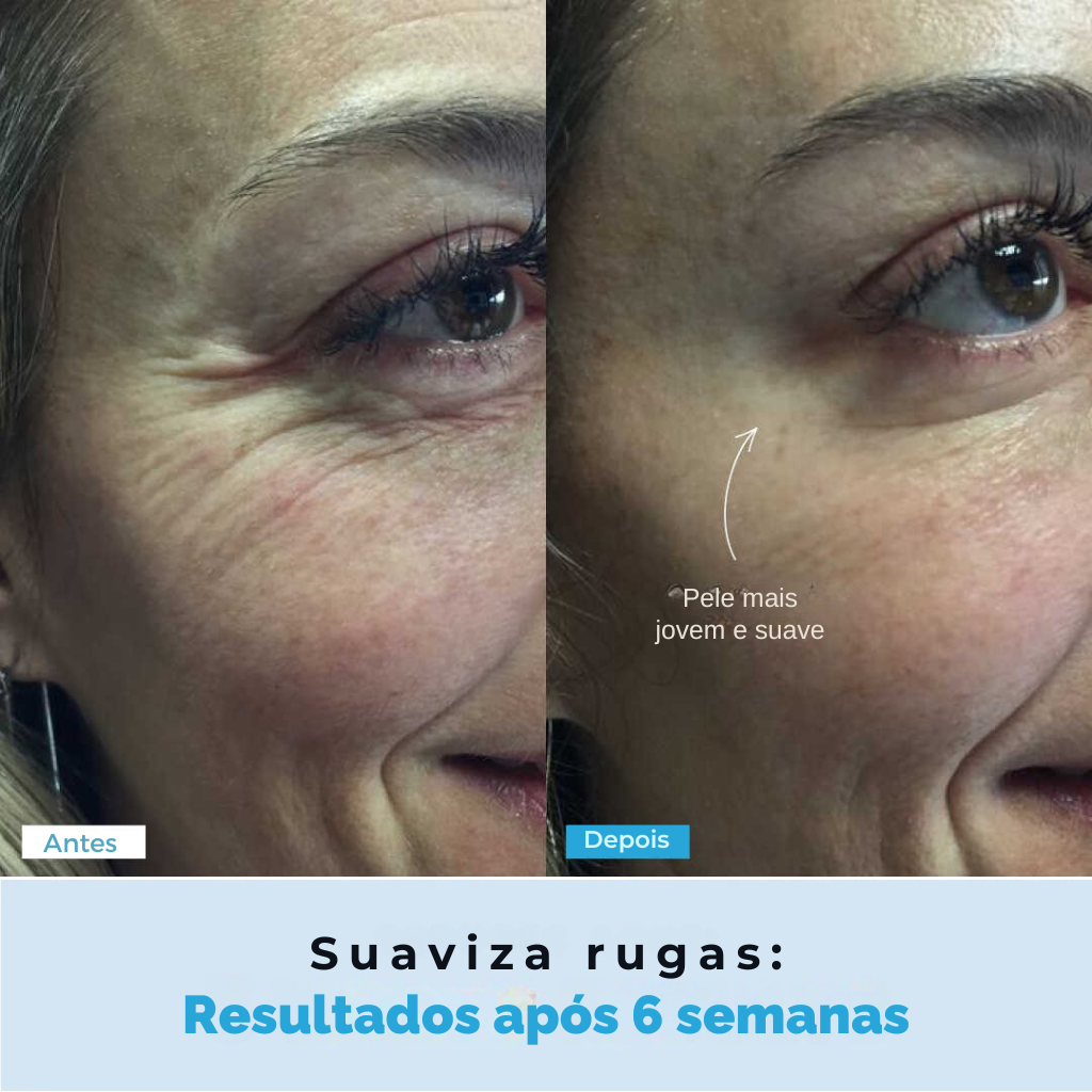 BelGlow Pro + Serum Grátis