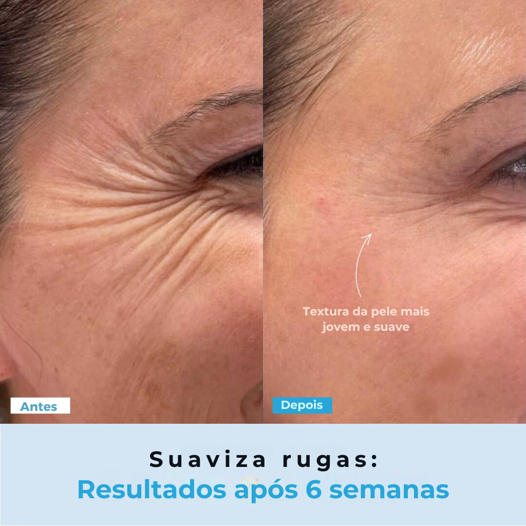 BelGlow Pro + Serum Grátis