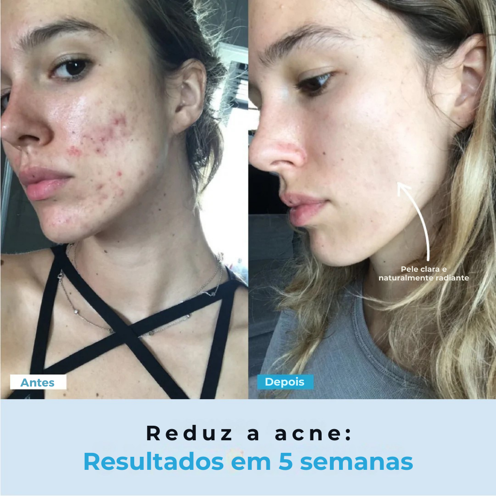BelGlow Pro + Serum Grátis