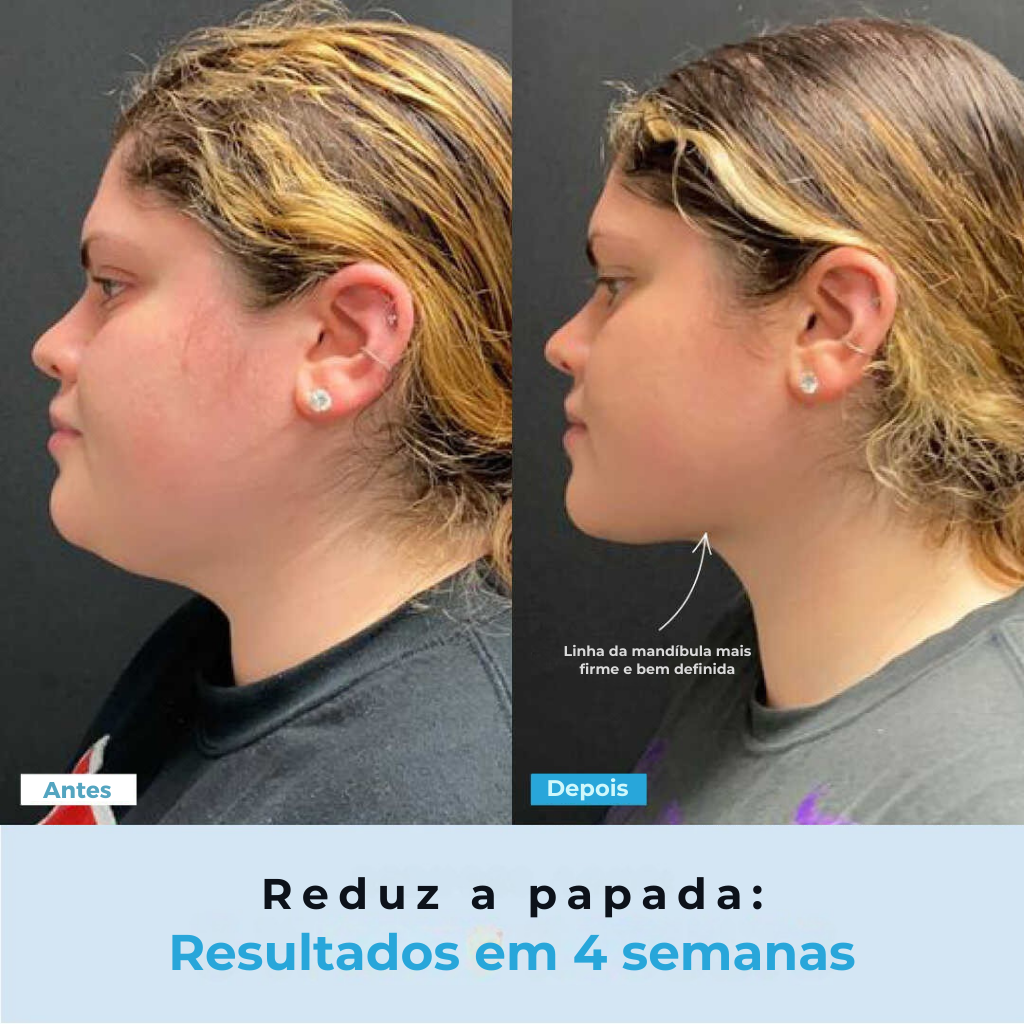 BelGlow Pro + Serum Grátis