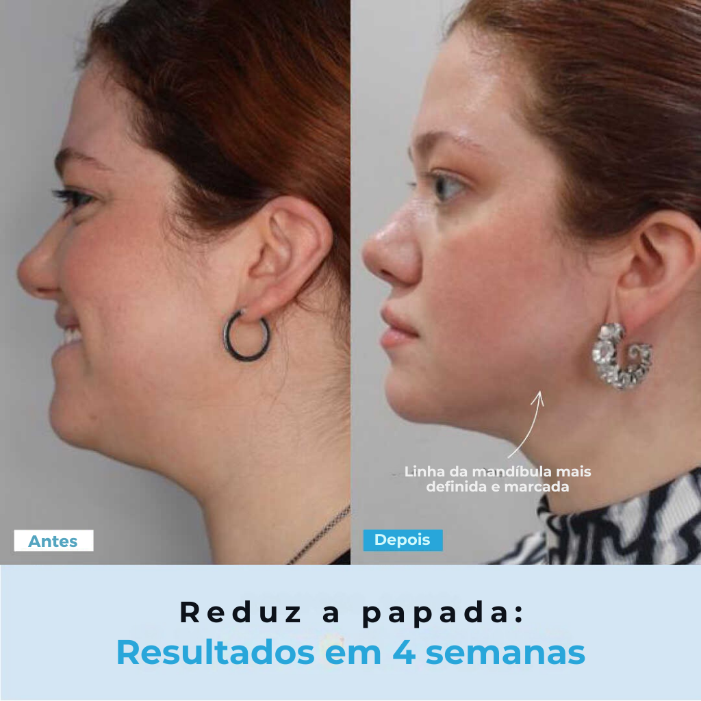 BelGlow Pro + Serum Grátis