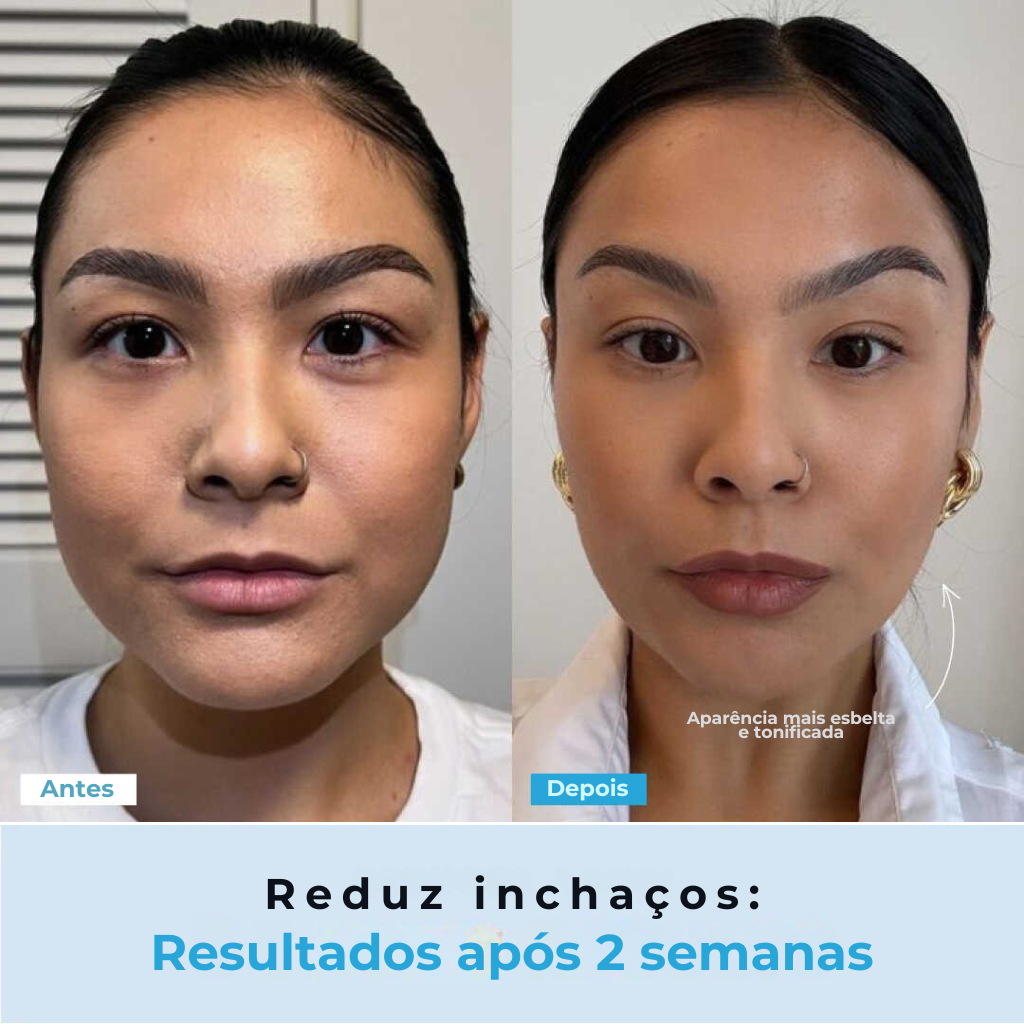 BelGlow Pro + Serum Grátis