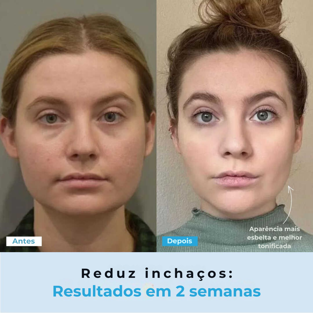 BelGlow Pro + Serum Grátis