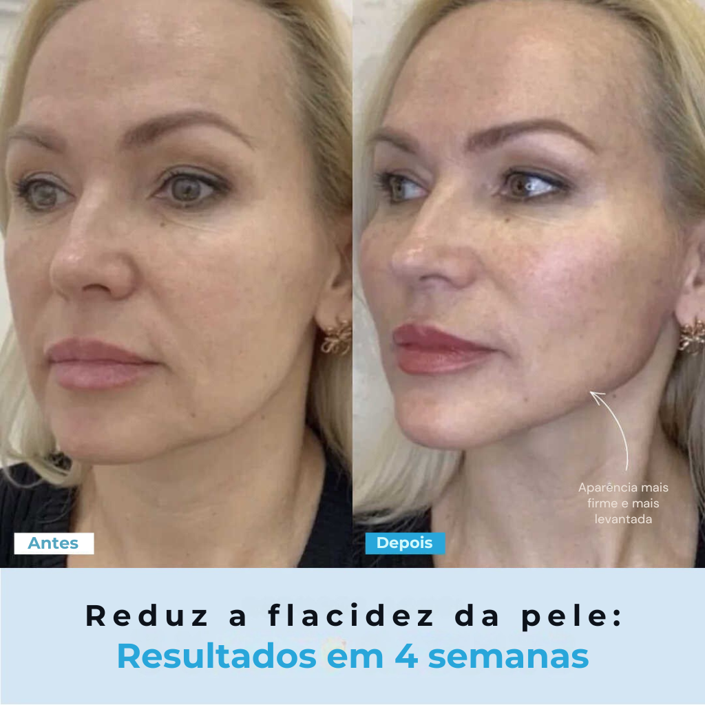 BelGlow Pro + Serum Grátis